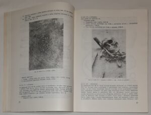 Cmentarzysko kultury łużyckiej w Łabędach-Przyszówce pow. Gliwice
